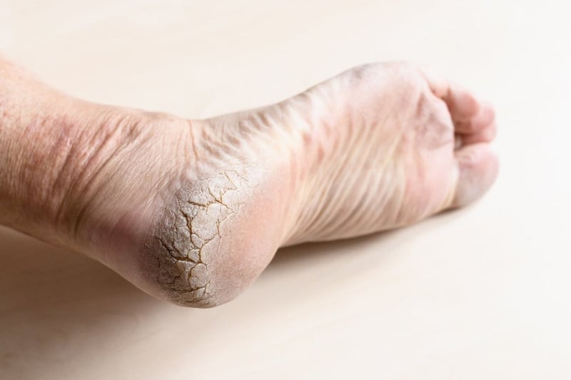 Kroko shares 5 ageing footcare tips to keep feet healthy in later years