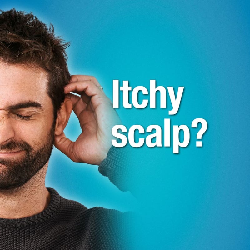 Men with dry, itchy scalp are a turn-off - poll