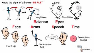 Tell tale signs of a stroke